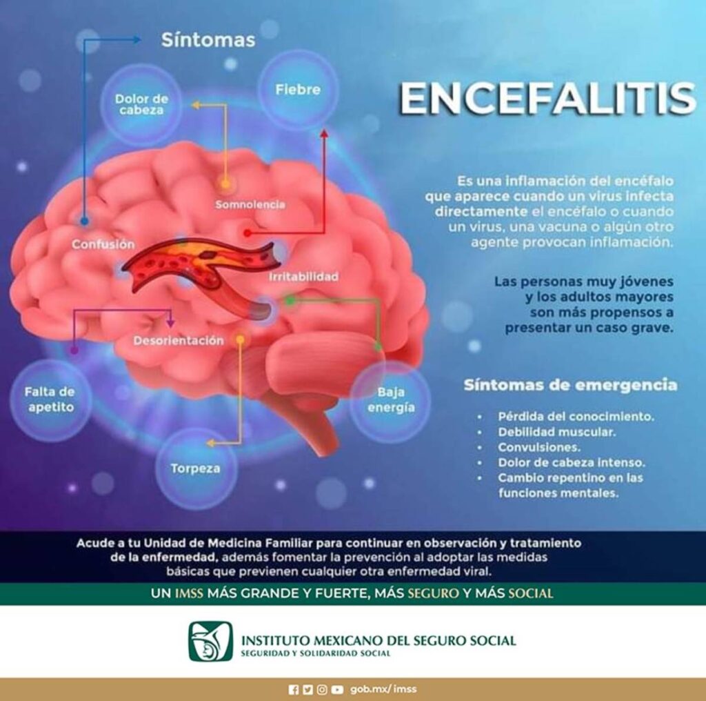 El Instituto Mexicano del Seguro Social (IMSS) en Veracruz Sur exhorta a la población a mantenerse alerta ante síntomas de encefalitis.